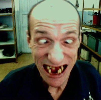 bad+teeth.jpg