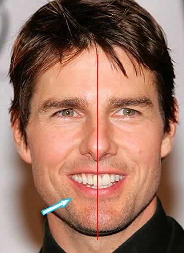 tom-cruise-front-teeth-alignment.jpg